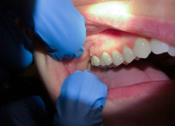 Best Emergency Treatment for Toothache in Waynesville, NC