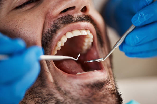 Best Same-Day Emergency Dentist in Waynesville, NC